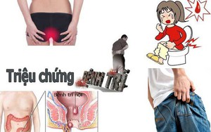 Bệnh trĩ – Không sớm điều trị, hậu quả khó lường