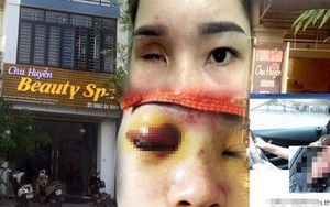 Cơ sở làm đẹp nâng mũi khiến cô gái bị mù vĩnh viễn đã bị đình chỉ hoạt động 3 tháng trước đó