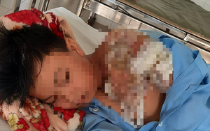 Thực hư thông tin bé trai 8 tuổi nghi bị bố bạo hành, đổ nước sôi lên người ở Long An