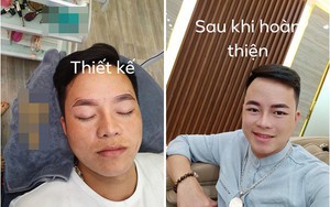 Chồng cô dâu 62 tuổi gây sốc với diện mạo mới sau khi được vợ "chơi lớn" cho đi tân trang nhan sắc
