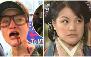 Nữ diễn viên nổi tiếng TVB bị người dân bức xúc, đánh trọng thương trên phố