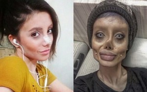 Cô gái 'xác sống' giống Angelina Jolie bị bắt