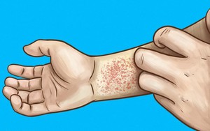 10 dấu hiệu cho thấy thận của bạn đang quá tải hoặc ngừng hoạt động