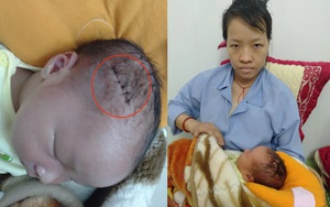 Gia đình bức xúc tố bác sĩ mổ sinh rạch trúng đầu thai nhi
