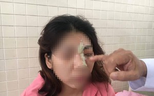 Cô gái 21 tuổi bị mù mắt sau khi tiêm filler nâng mũi