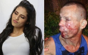 Cướp nhầm nữ đô vật UFC xinh đẹp, tên trộm đen đủi bị đánh cho bầm dập mặt mũi phải cầu cứu cảnh sát