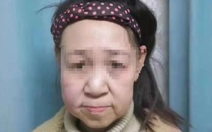 Thiếu nữ 15 tuổi bị gọi là 'quái vật' vì gương mặt như bà lão 60