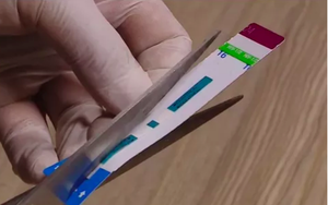 Cắt đôi que thử HIV, viêm gan B tại BV Xanh Pôn: Giám đốc Sở Y tế nói 'quyết không bao che'