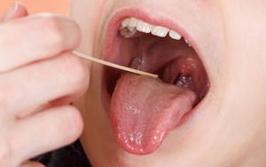 Đau họng có kèm 5 dấu hiệu sau, bạn nên đi khám để tránh chịu hậu quả đáng tiếc