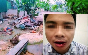 Thầy giáo ném thanh sắt làm cán bộ tòa án gãy 5 chiếc răng: "Tôi buồn và rất hối hận"
