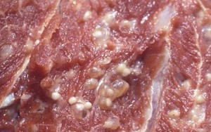 Không có ý nghĩa điều trị, vì sao vẫn để hàng ngàn trẻ xét nghiệm Elisa tìm sán lợn?