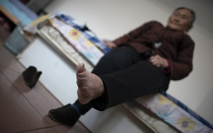 Đôi chân biến dạng cả đời của người phụ nữ cuối cùng theo tục 'bó chân gót sen' ở Trung Quốc