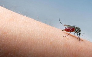 10 cách trị vết muỗi đốt ngay tức thì mà không cần bôi thuốc