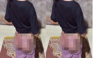 Bé gái bị công an viên đánh bầm dập mông vì lấy trộm 50 nghìn đồng