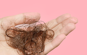 Top 3 cách trị rụng tóc hiệu quả cực nhanh, áp dụng được cho cả nam và nữ