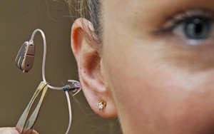 Máy trợ thính điều khiển bằng suy nghĩ