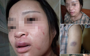 Chồng đánh vợ mang thai tháng thứ 8, nói "không phải chỉ vì chuyện mua đôi giày"