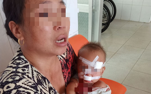 Mẹ bé gái bị cha ruột ném ly vào mặt, khâu 12 mũi: "Lúc 13 tháng, con bé cũng bị ném vật cứng làm chấn thương sọ não"