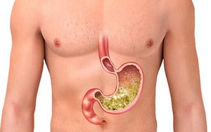 3 nhóm thực phẩm tuyệt đối nên tránh ăn khi bạn đói bụng để không "phá nát" dạ dày