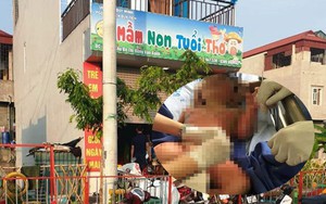 Cô giáo đổ cồn vào mâm châm lửa làm giáo cụ dạy trẻ, gió lớn tạt qua khiến 3 bé bỏng nặng