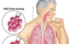 Căn bệnh khiến nam sinh phải mang bình oxy đi thi: Vì sao không thể chẩn đoán ra?