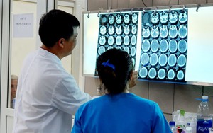 Chưa từng xảy ra ở Việt Nam: Nam thanh niên bị xuất huyết não do dùng ma tuý đá