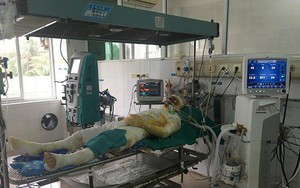 Cụ ông tử vong do đến thầy lang chữa bỏng