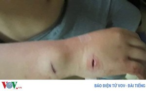 Tạm giữ đối tượng dùng dao tấn công 1 học sinh lớp 6 ở Điện Biên