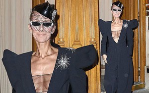 Celine Dion lại gây sốc khi diện váy xẻ sâu khoe ngực với cơ thể nhăn nheo