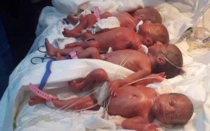 Chuyện lạ mà có thật: Bà mẹ vượt cạn với số lượng con 'khủng' chưa từng thấy, nghe xong ai cũng ngã ngửa