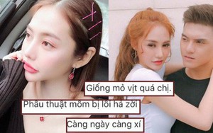 Linh Chi đáp trả khi bị chê phẫu thuật thẩm mỹ lỗi, miệng trông giống mỏ vịt