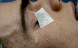 Lên bàn mổ đã sợ, vậy chuyện gì sẽ xảy ra nếu hết thuốc mê giữa chừng?