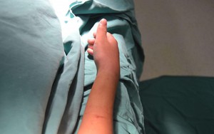 Bé trai 11 tuổi bị biến dạng cẳng tay sau một tháng đắp thuốc nam