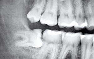 Chỉ vì chần chừ mãi không chịu làm điều này, bà mẹ mang thai 6 tháng buộc lòng phải từ bỏ con