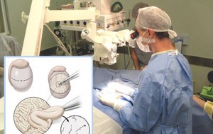 Nam giới không có tinh trùng le lói hy vọng được làm cha