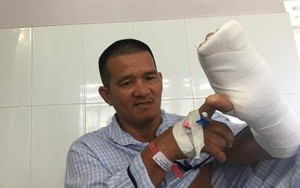 'Hiệp sĩ' Bình Dương bị thanh niên ngáo đá chém đứt gân tay