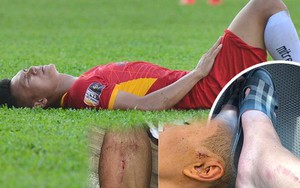 Hãi hùng với chấn thương của các cầu thủ thi đấu V.League: Ai nói bóng đá Việt nhàm chán và thiếu lửa?