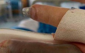 Đi làm nail ở tiệm quen nhiều năm trời, ngón tay của người phụ nữ bất ngờ bị hoại tử và suýt phải cắt bỏ vì nhiễm trùng