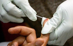 Đối tượng nhiễm HIV lao vào cắn 3 nữ chiến sỹ công an
