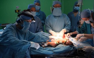 Hai bé sơ sinh dính nhau phần gan được phẫu thuật thành công