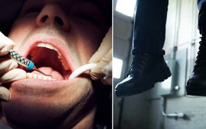 Anh: Đau răng khôn mãi mà không được bác sĩ nhổ, 1 người đàn ông treo cổ tự sát