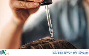 Bỏ túi 8 bí kíp ngăn ngừa gàu hiệu quả trong mùa hanh khô