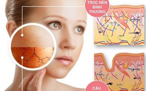 Mùa đông có cần bôi kem chống nắng?