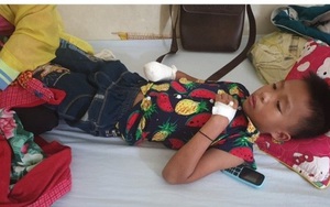 Đèn pin phát nổ khi sạc, bé trai 10 tuổi bị dập nát bàn tay