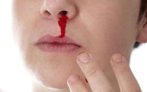 Chảy máu mũi thường xảy ra vào mùa nào?