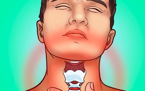 10 dấu hiệu cho thấy cơ thể đang thiếu I-ốt - một chất quan trọng cho cơ thể