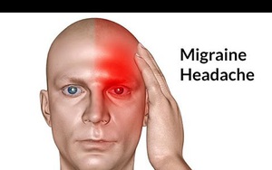 Bác sĩ cảnh báo: Đau đầu có những dấu hiệu bất thường sau cần phải đến viện gấp