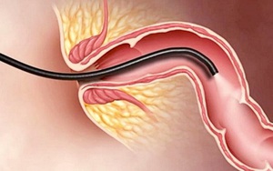 Bác sĩ khuyến cáo: Những dấu hiệu cảnh báo có thể là ung thư, nên chú ý đi khám sớm