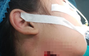 BS BV Nhi TƯ cảnh báo: Nhiều trẻ phải nhập viện do tai nạn trong kỳ nghỉ dài