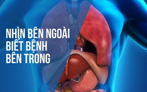 BS hướng dẫn cách "nhìn ngoài thấy trong" để xem bạn đang khỏe hay có bệnh: Rất hữu ích